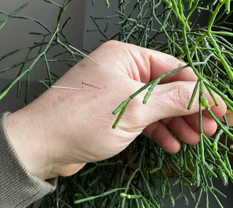 Acupuncture Needles